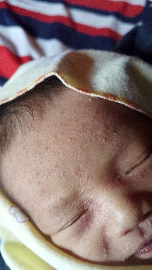 Kira2 in penyebabnya apa ya Bun?