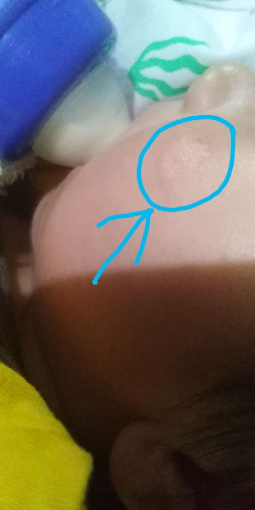 Dry and rough sa mukha ni baby