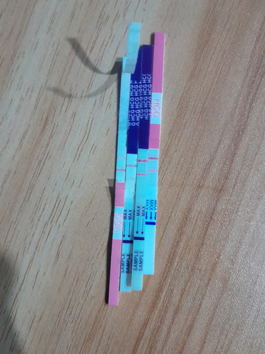 ประจำเดือนขาด