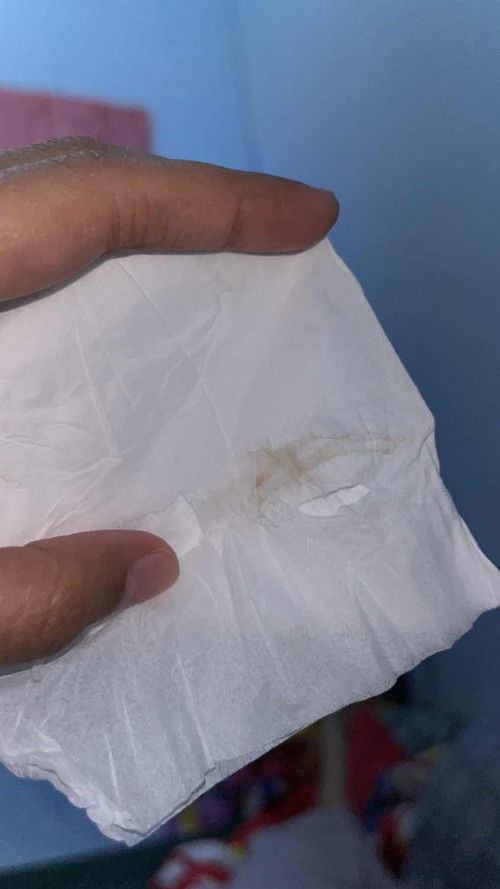 Flek usia kandungan 7week