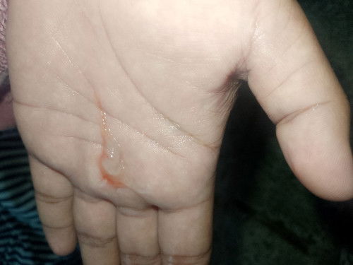 Hello mga mi ask ko lng kung sign na ba to kung malapit na ba akong manganak???