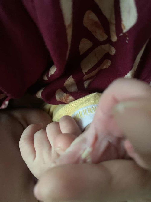 Solusinya dong bun🙏🏻