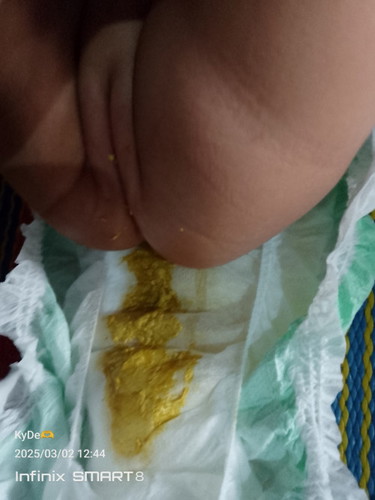 hello po, sino po s26 pink user dito? always po ba nag popoop si lo niyo? pero di naman po watery.