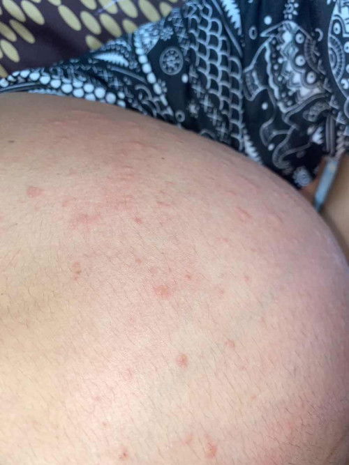 สอบถามแม่ๆคะ