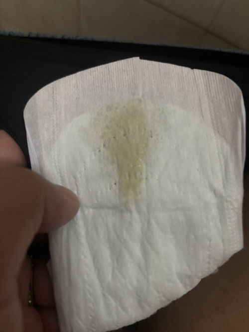 แม่มีตกขาว หลังคลอดน้องได้ 4 เดือน