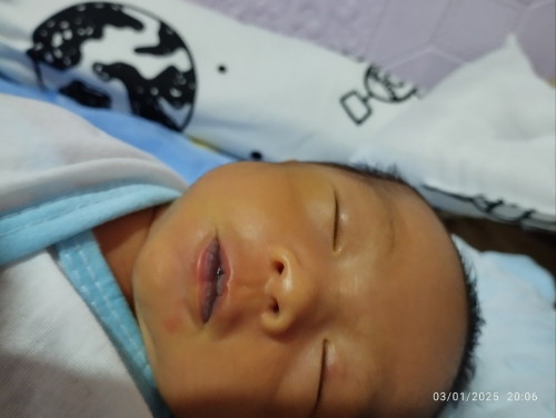 Maitim na labi ng newborn