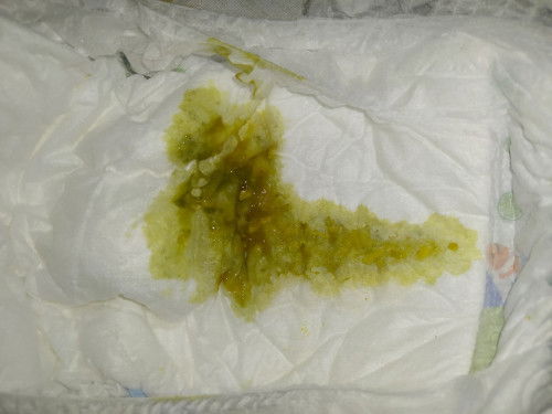 Bayi 7 bulan ee terus apakah diare?