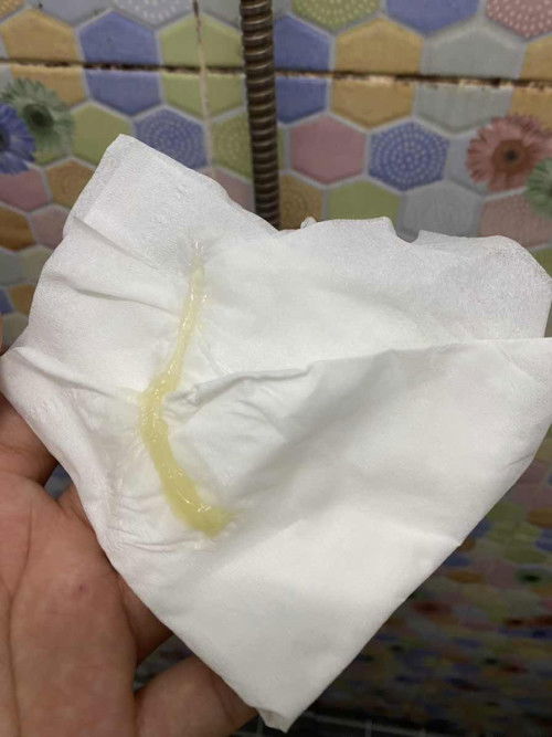 สอบถามแม่ๆหน่อยค่ะ