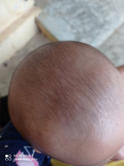 Produk buat penumbuh rambut