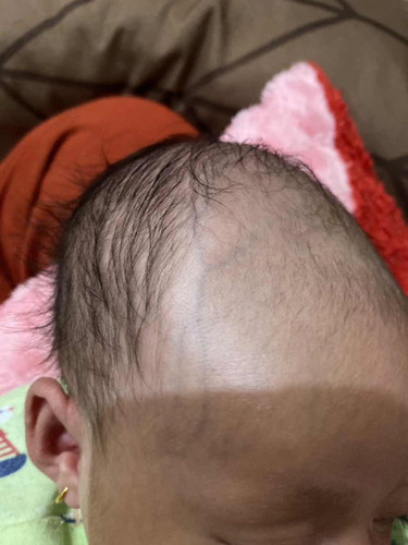 Kepala bayi