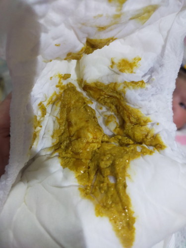 ลูก 4 เดือน ถ่ายเหลวเป็นสีเหลืองมีมูก ถ่ายวันละ3-5ครั้งต่วัน ร่าเริงกินได้ปกติ ไม่ไข้ ไม่ซึม