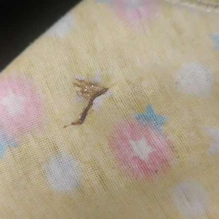 Pasintabi po. Normal lg ba to sa 7weeks