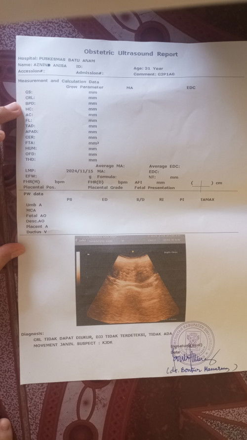 Hari ini saya pemeriksaan ke 2 di puskesmas . Usia 12 week Dan hasil ny saya besok di suruh kuret.