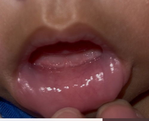 3เดือน26วันแม่กังวลใจมากเลย