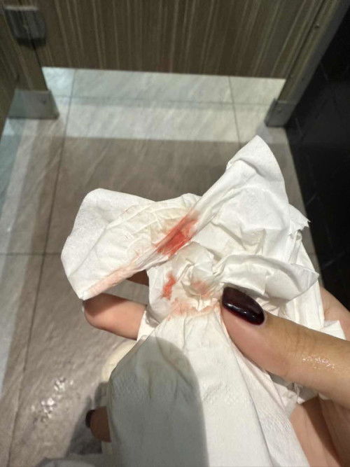 เลือดออกไม่รู้เพราะอะไร