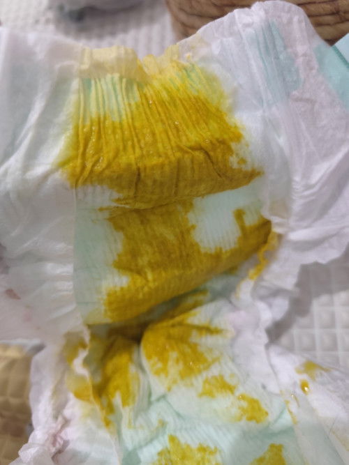 Bab seperti ini termasuk diare bukan