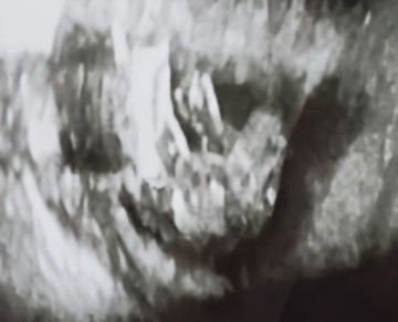 ช่วยคอนเฟิร์มหน่อยค่ะแม่ๆ