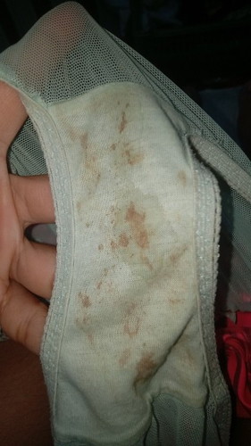 Bun aku abis nyuci banyak trus keluar plek kaya lem tapi warna kehitaman..bahaya gak ya..