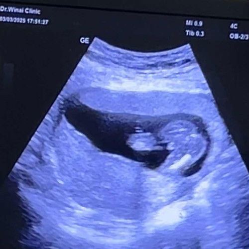 ทีมไหนกันค่ะ แม่ๆ. มาอวดน้องกันจ้า  ทางนี้ยังไม่รู้สึกน้องดิ้น    ท้องที่3แล้วจ้า