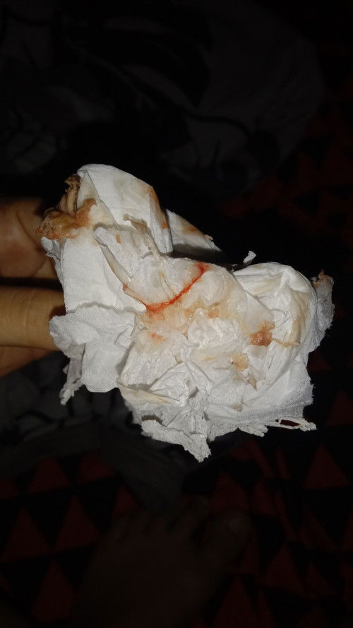 Bun disini ada yg udah ngalamin kontraksi sampe flek 
Hpl Maret tnggl 10