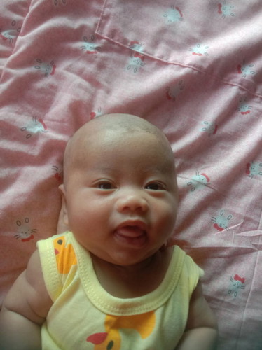 ไอ้ต้าวโล้น 👶