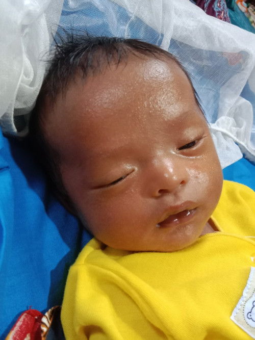 Muka anakku bruntusan kecil gini 😭