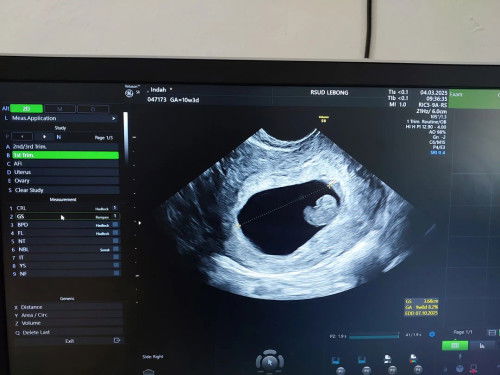 Mengikhlaskan untuk kedua kalinya 😊