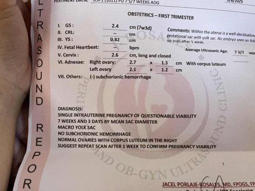 Suspected for blighted ovum