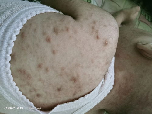 Bun mau tanya dong ini badan ank aku kenapa ya