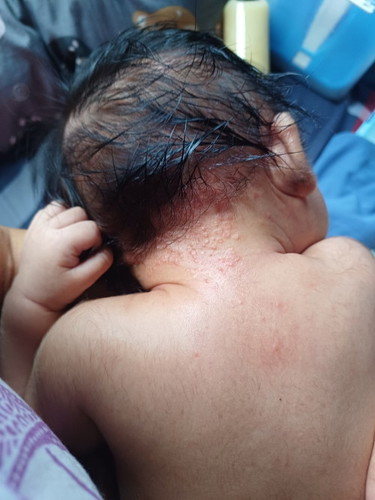 Bunda2 ada gak anak ny begini??
Ini knp ya??
