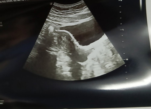 Ni kantung ka hampa
Maaf haritu saya ada g scan tapi saya lupa doc terang pasai ni
