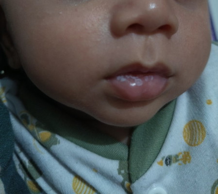 Bun mau tanya, di bibir dekbay kok ada putih putih seperti ini kenapa ya?