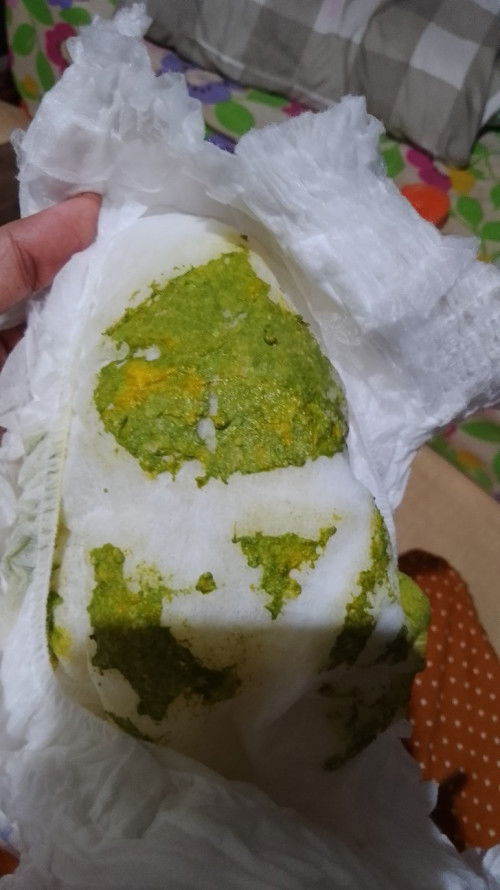 Pup bayi ijo rewel dan kl nyusu rusuh sampe muka merah