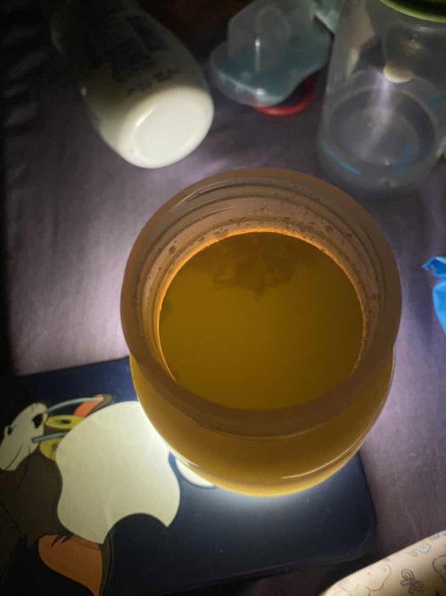 ปั้มนมแล้วมีก้อนสีขาวออกมาเกิดจสกอะไร