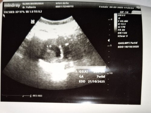 Belum terlihat janin