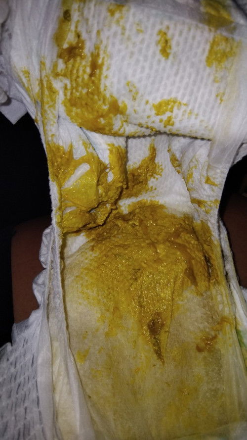 อยากสอบถามเเบบนี้เรียกถ่ายเป็นมูกไมคะ