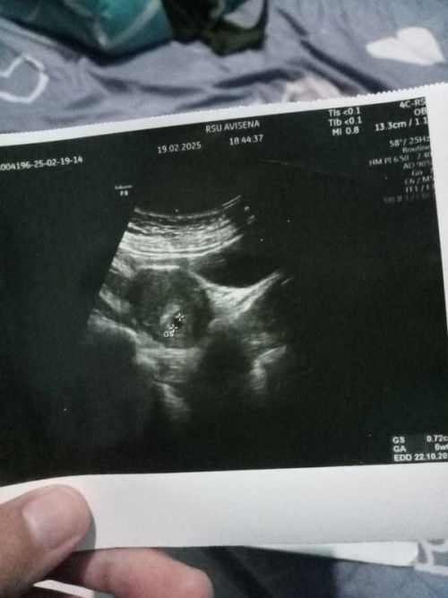 Cerita sedikit tentang kebobolan hamil lagi;)