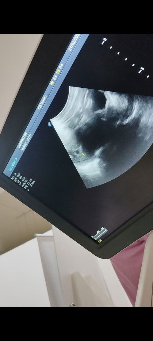 สอบถามแม่ๆ