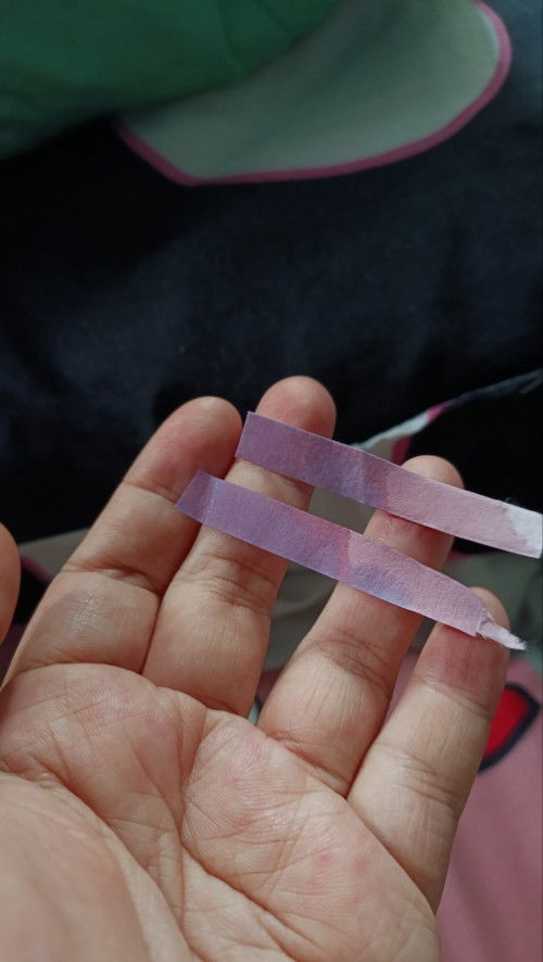 Ketuban rembes uk 32 week