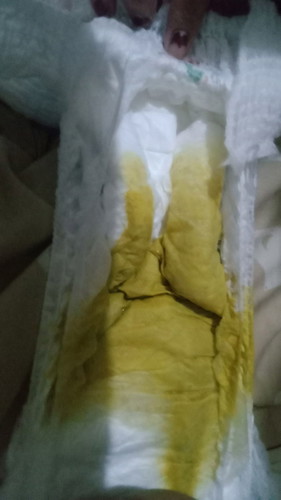 Bunda'aku mau nnya,eek anakku kaya gini tuh normal atau tidak ya?ful asi
Usia 3 bulan