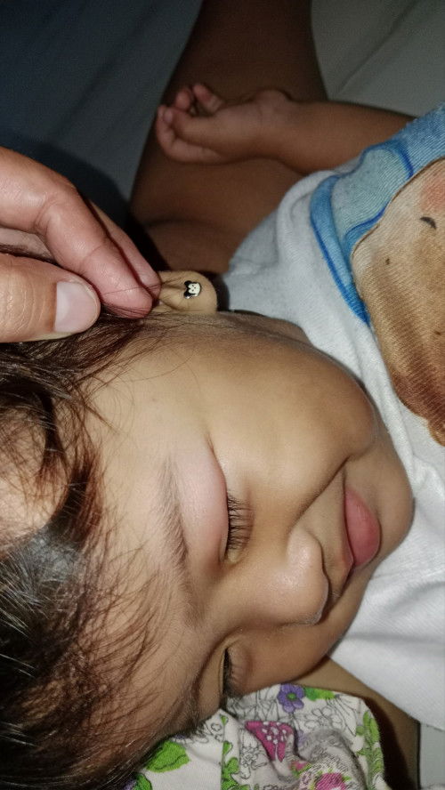 Mata bengkak binggung digigit semut atau knp