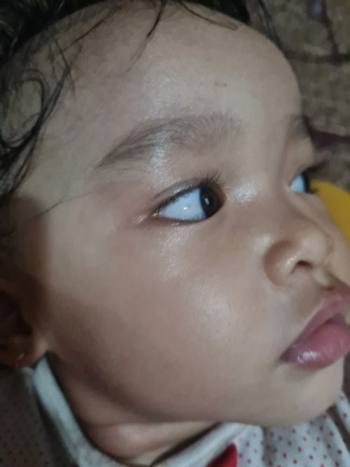 Mau tanya mata baby ada bintik hitam