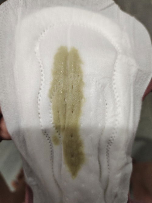 Darah nifas lebih dari 40 hari