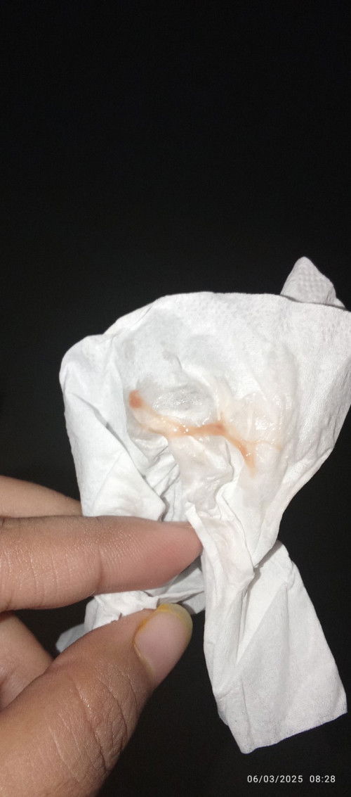 Seperti flek bukan flek, atau bercak?