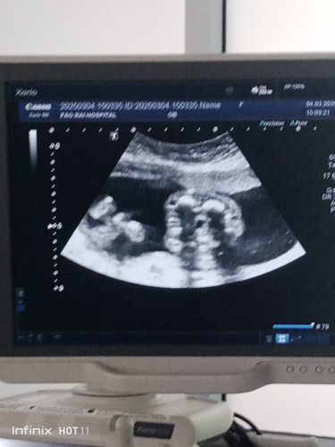 แม่รู้เพศกันหรือยังค่ะ20วีคค่ะ