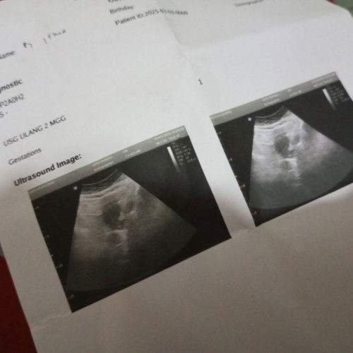 Usg ulang 2 Minggu lagi apa ada yg sama?