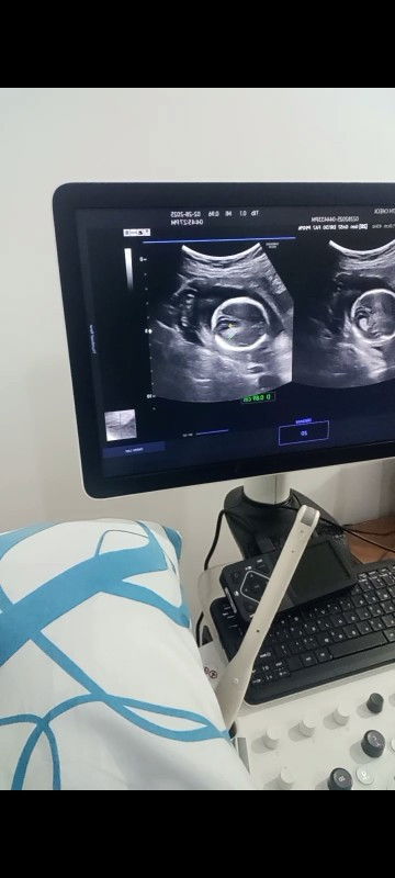 20 weeks and 1 day
Due date 07/23/25