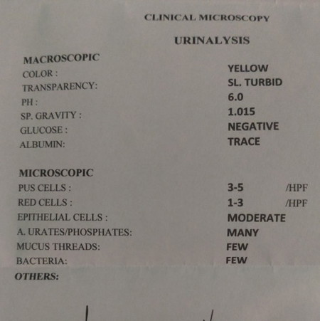 URINALYSIS LAB RESULT