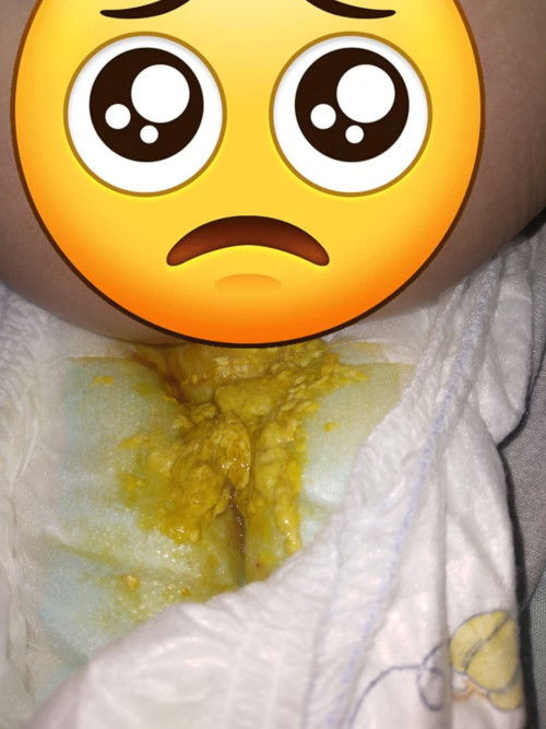 Na**s baby berlendir.