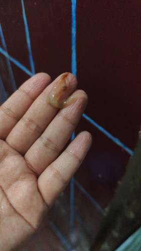Maaf klo geli mau tanya ini lendir apa ya mom? Karna masih konpal kadang muncul dan gak usia 38week
